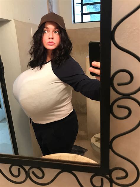 real life breast expansion|“My Breasts Grew 4 Sizes in 8 Months”: A Story of Gigantomastia